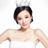 王楚钦手指磕伤流血